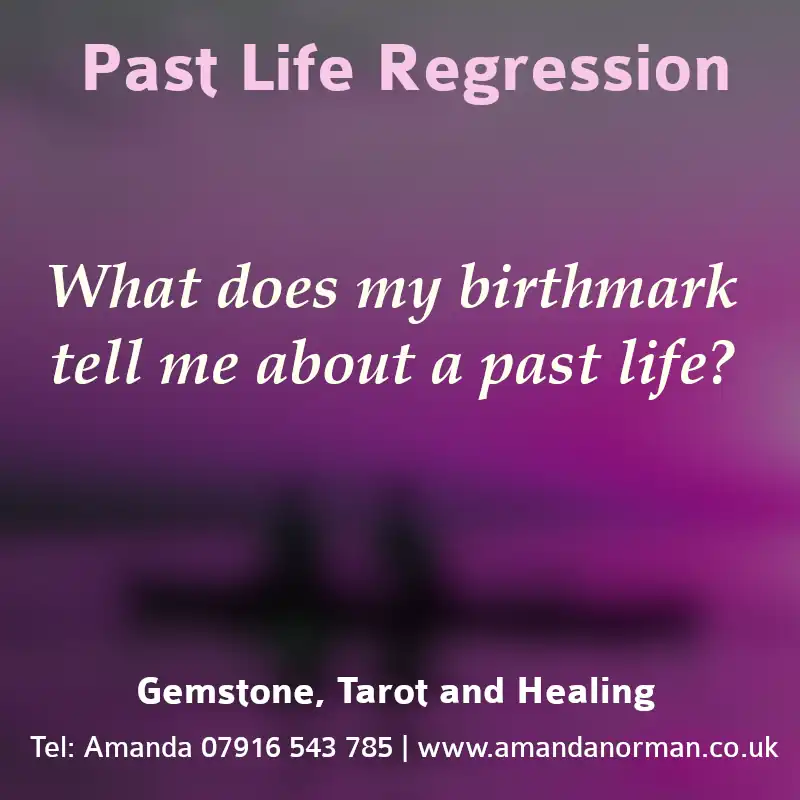Birthmark and Past Life